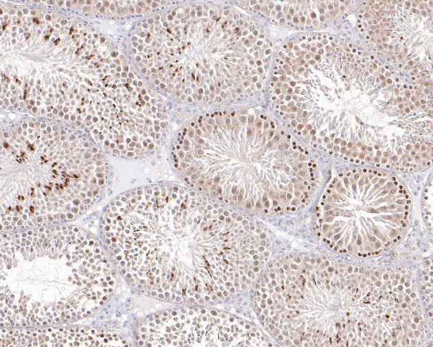 MCRS1 Antibody in Immunohistochemistry (Paraffin) (IHC (P))