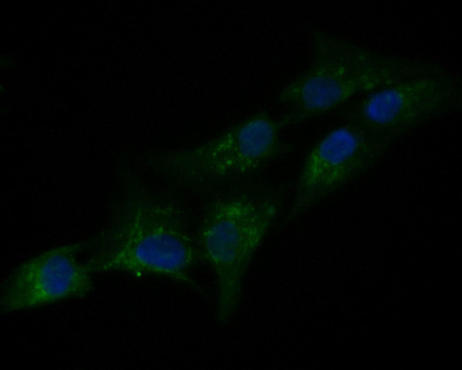 PAI1 Antibody in Immunocytochemistry (ICC/IF)