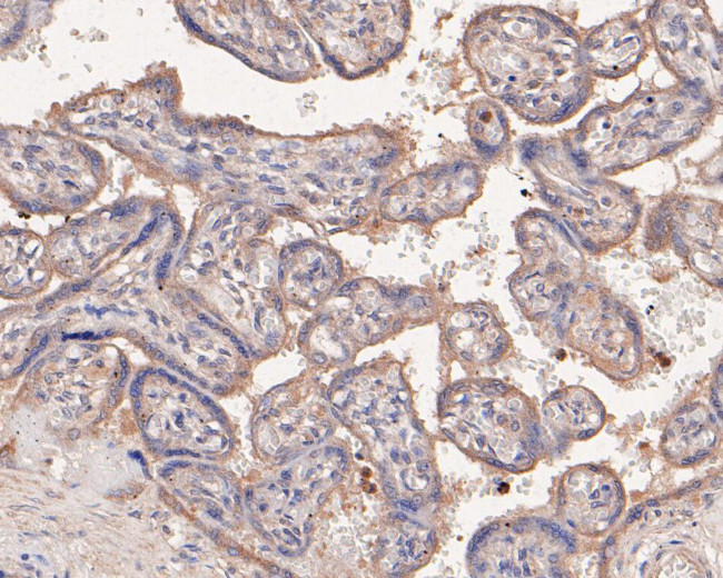 PAI1 Antibody in Immunohistochemistry (Paraffin) (IHC (P))