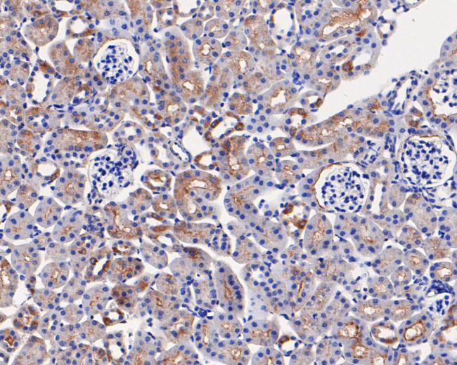 PAI1 Antibody in Immunohistochemistry (Paraffin) (IHC (P))