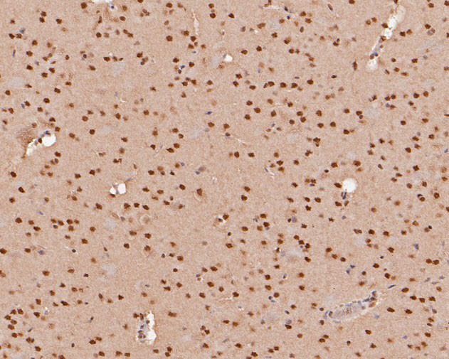 THOC5 Antibody in Immunohistochemistry (Paraffin) (IHC (P))