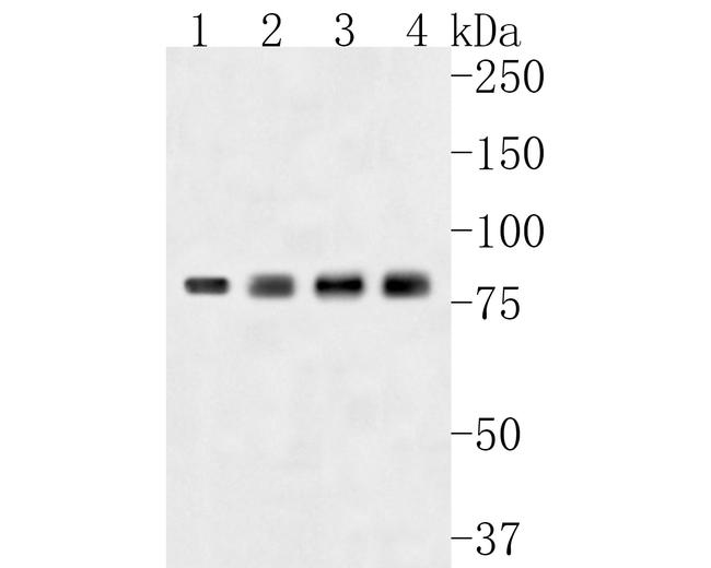 THOC5 Antibody in Western Blot (WB)