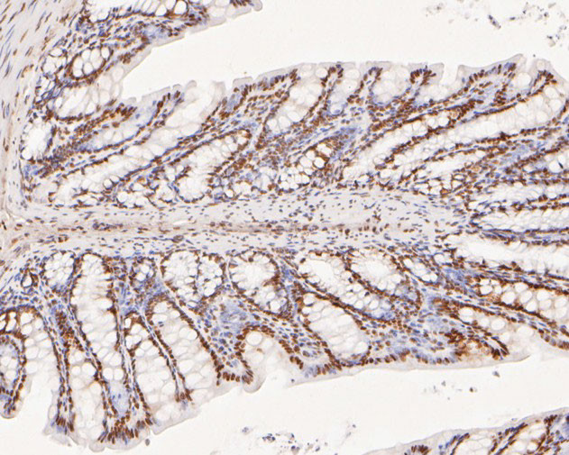 XPA Antibody in Immunohistochemistry (Paraffin) (IHC (P))