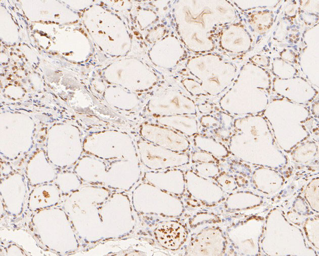 XPA Antibody in Immunohistochemistry (Paraffin) (IHC (P))