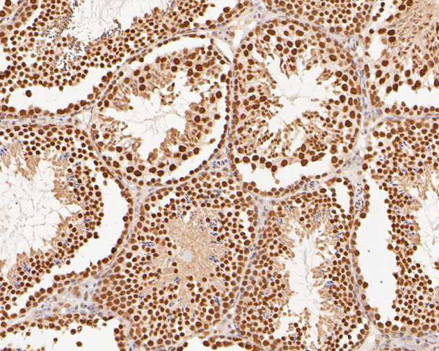 XPA Antibody in Immunohistochemistry (Paraffin) (IHC (P))