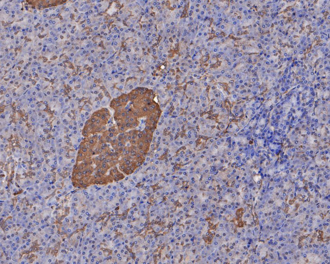 GNAO1 Antibody in Immunohistochemistry (Paraffin) (IHC (P))