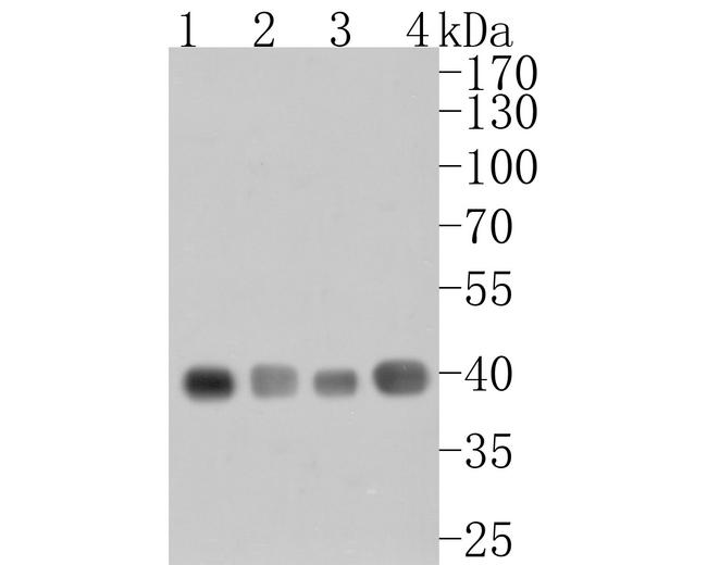 GNAO1 Antibody in Western Blot (WB)