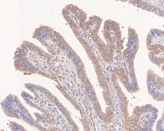 TNFR1 Antibody in Immunohistochemistry (Paraffin) (IHC (P))