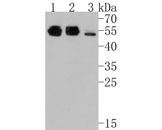 TNFR1 Antibody in Western Blot (WB)