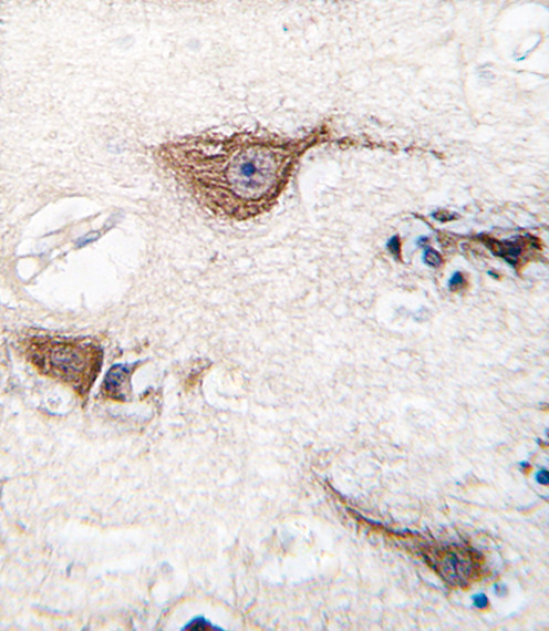 PGP9.5 Antibody in Immunohistochemistry (Paraffin) (IHC (P))