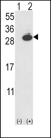 PGP9.5 Antibody in Western Blot (WB)