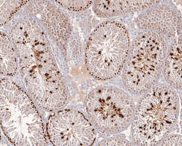 XRCC2 Antibody in Immunohistochemistry (Paraffin) (IHC (P))