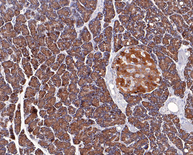 RAB3d Antibody in Immunohistochemistry (Paraffin) (IHC (P))