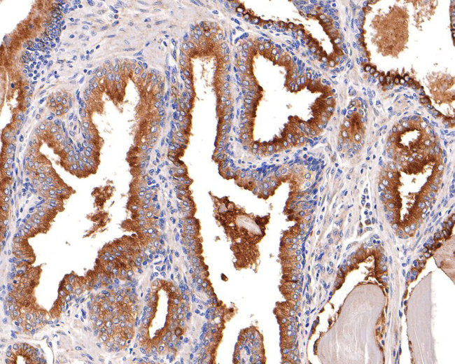 RAB3d Antibody in Immunohistochemistry (Paraffin) (IHC (P))