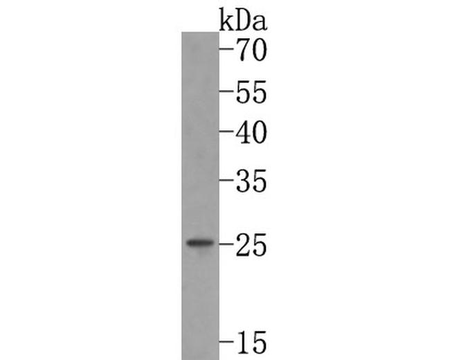 RAB3d Antibody in Western Blot (WB)