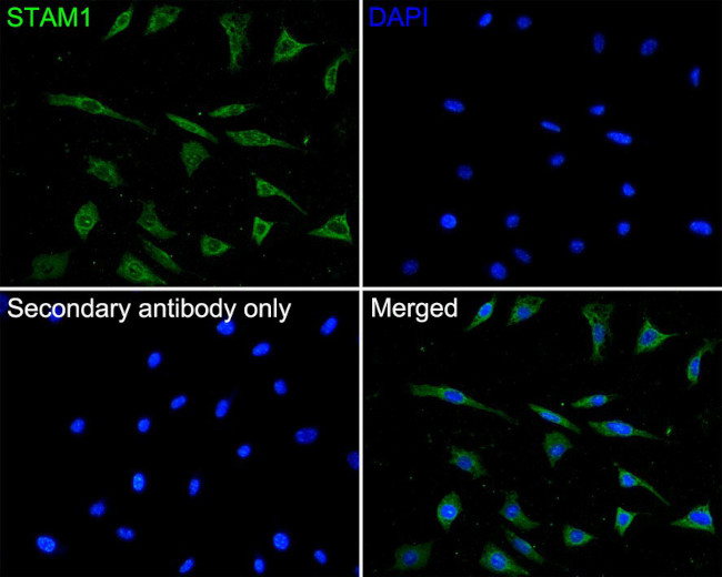 STAM Antibody in Immunocytochemistry (ICC/IF)