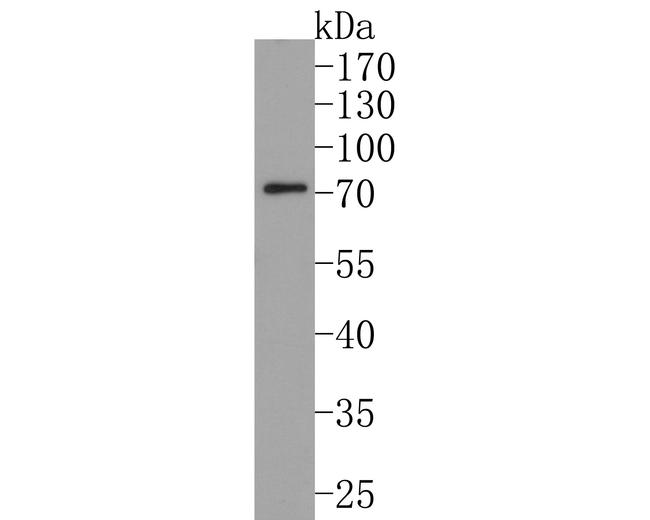 STAM Antibody in Western Blot (WB)