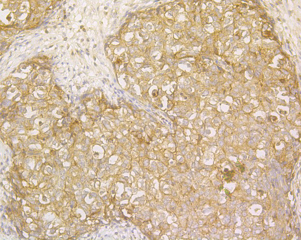 ENAH Antibody in Immunohistochemistry (Paraffin) (IHC (P))