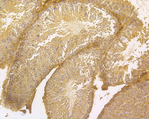 ENAH Antibody in Immunohistochemistry (Paraffin) (IHC (P))