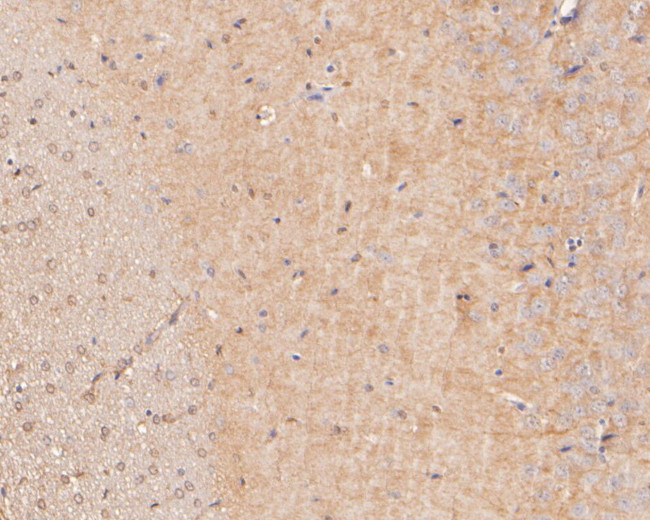 PPP1R9A Antibody in Immunohistochemistry (Paraffin) (IHC (P))