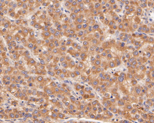 PPP1R9A Antibody in Immunohistochemistry (Paraffin) (IHC (P))