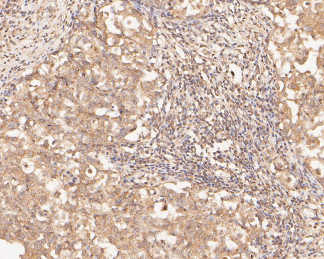 ZFHX3 Antibody in Immunohistochemistry (Paraffin) (IHC (P))