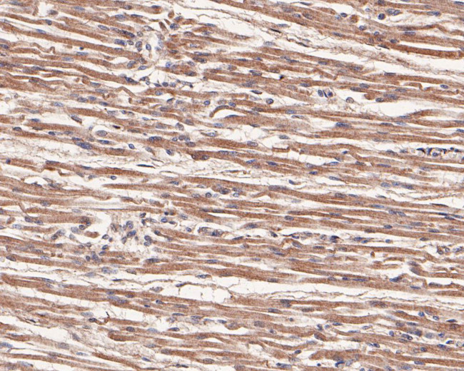 VLDLR Antibody in Immunohistochemistry (Paraffin) (IHC (P))