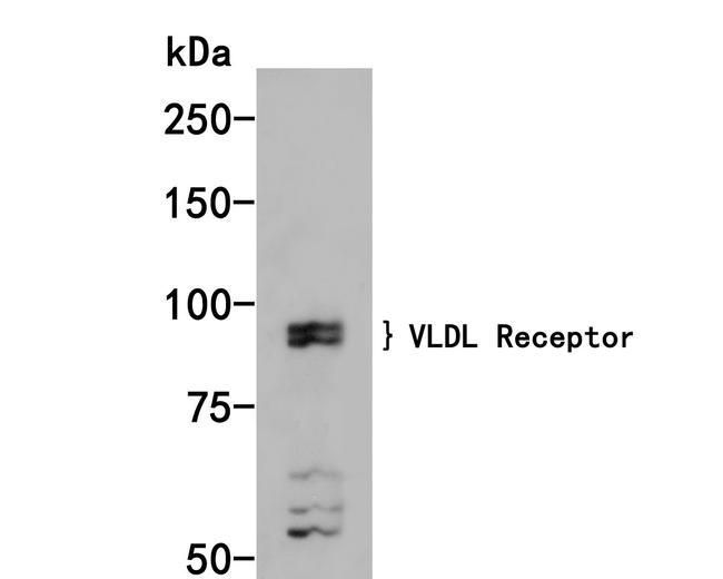 VLDLR Antibody in Western Blot (WB)