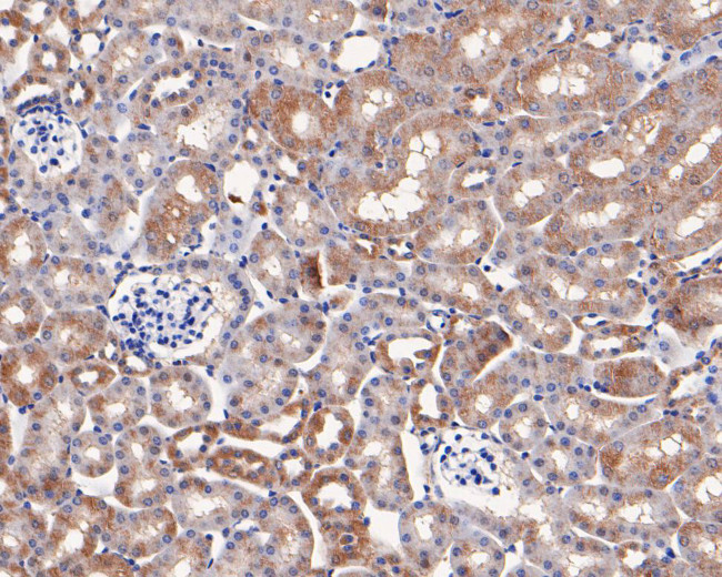 CYP24A1 Antibody in Immunohistochemistry (Paraffin) (IHC (P))