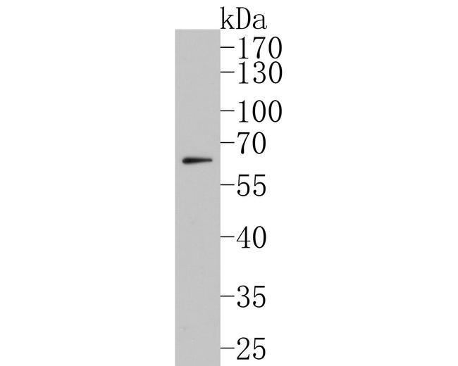 CYP24A1 Antibody in Western Blot (WB)