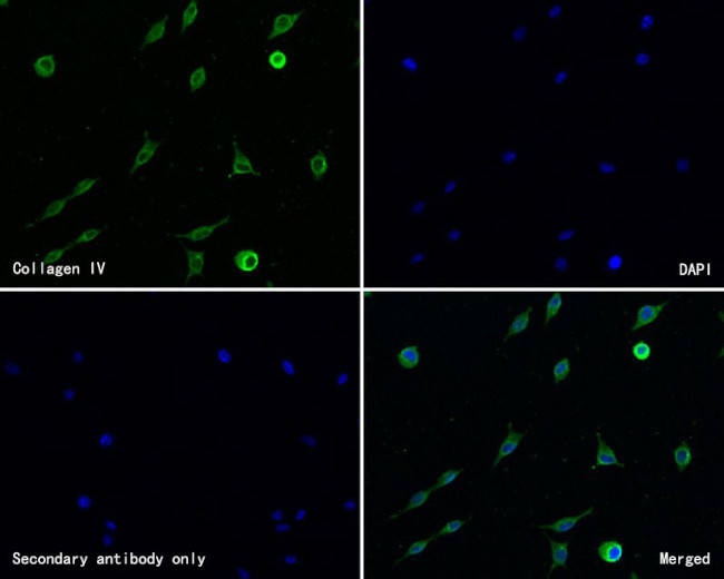 Collagen IV Antibody in Immunocytochemistry (ICC/IF)