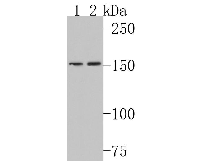 Collagen IV Antibody in Western Blot (WB)