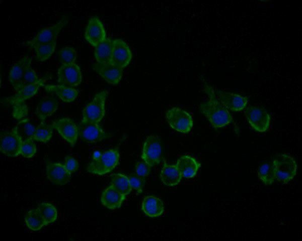 TSC1 Antibody in Immunocytochemistry (ICC/IF)