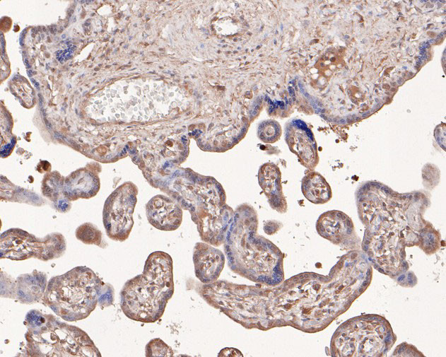 TSC1 Antibody in Immunohistochemistry (Paraffin) (IHC (P))