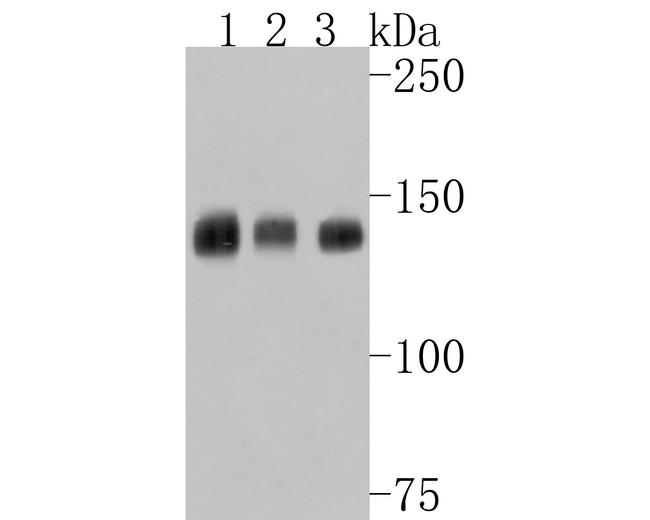 TSC1 Antibody in Western Blot (WB)