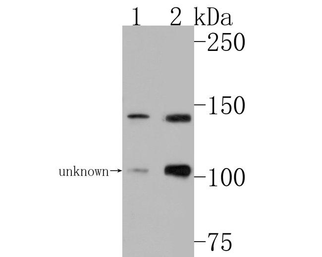 TSC1 Antibody in Western Blot (WB)