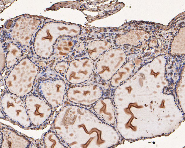 PFKFB2 Antibody in Immunohistochemistry (Paraffin) (IHC (P))