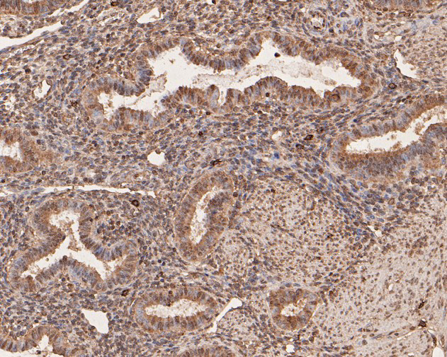 PFKFB2 Antibody in Immunohistochemistry (Paraffin) (IHC (P))