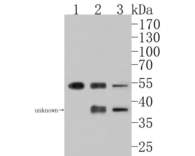 PFKFB2 Antibody in Western Blot (WB)