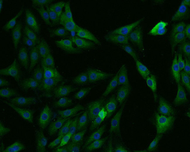 CATSPER4 Antibody in Immunocytochemistry (ICC/IF)