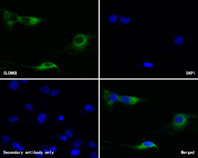 CLCNKB Antibody in Immunocytochemistry (ICC/IF)