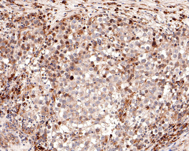 CLCNKB Antibody in Immunohistochemistry (Paraffin) (IHC (P))