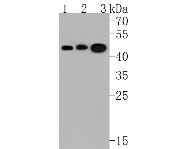 Kallikrein 11 Antibody in Western Blot (WB)