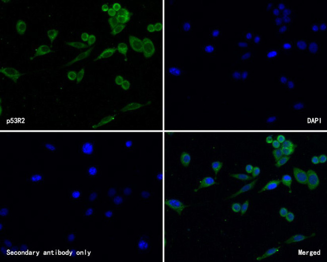 p53R2 Antibody in Immunocytochemistry (ICC/IF)