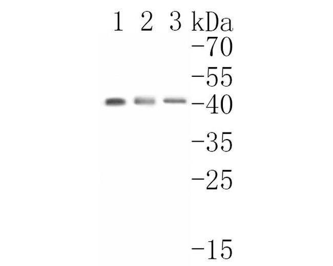 p53R2 Antibody in Western Blot (WB)