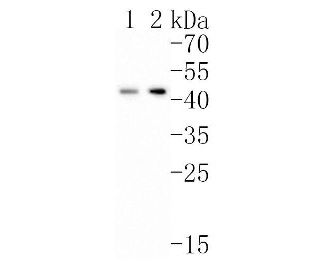 p53R2 Antibody in Western Blot (WB)
