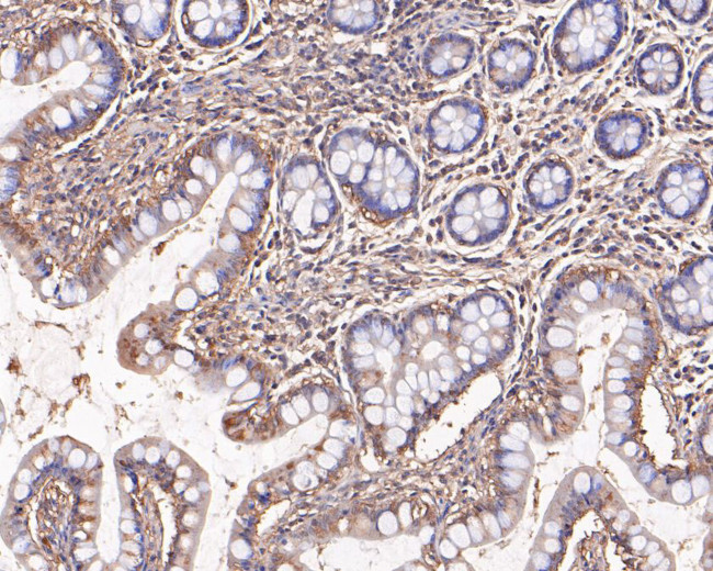 Presenilin 1 Antibody in Immunohistochemistry (Paraffin) (IHC (P))