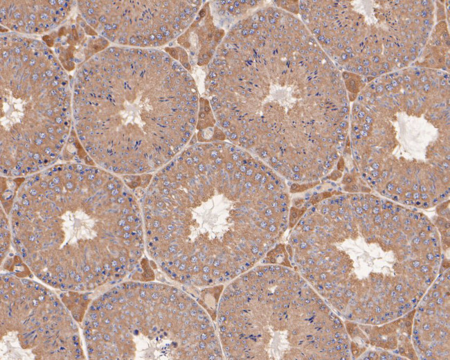 Presenilin 1 Antibody in Immunohistochemistry (Paraffin) (IHC (P))