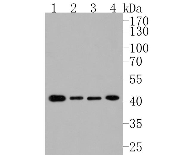 Presenilin 1 Antibody in Western Blot (WB)