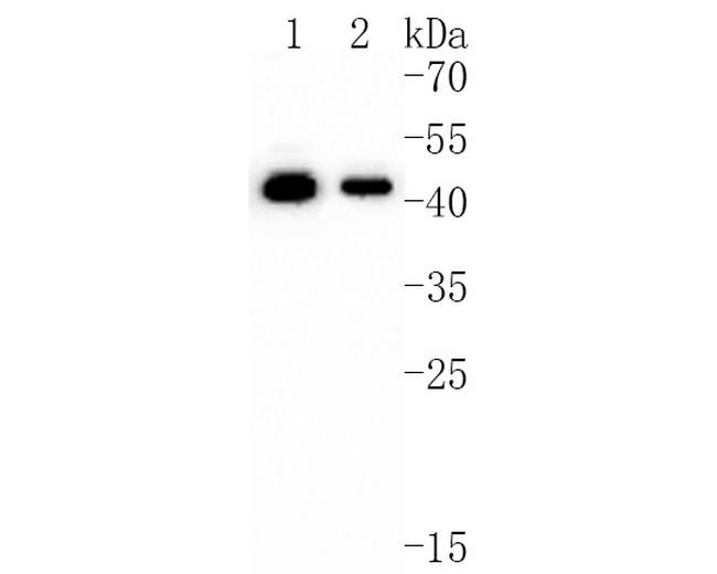 Presenilin 1 Antibody in Western Blot (WB)